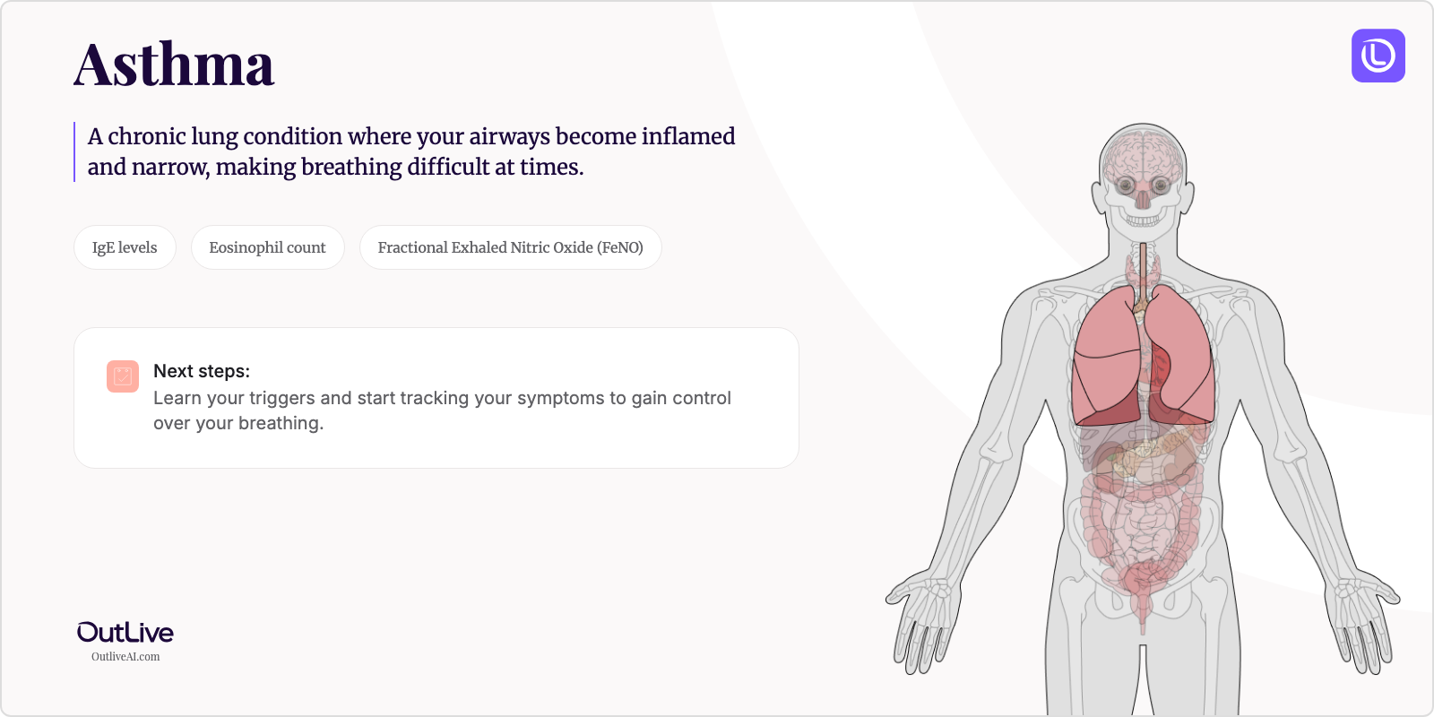 Just Diagnosed with Asthma: A Simple Guide