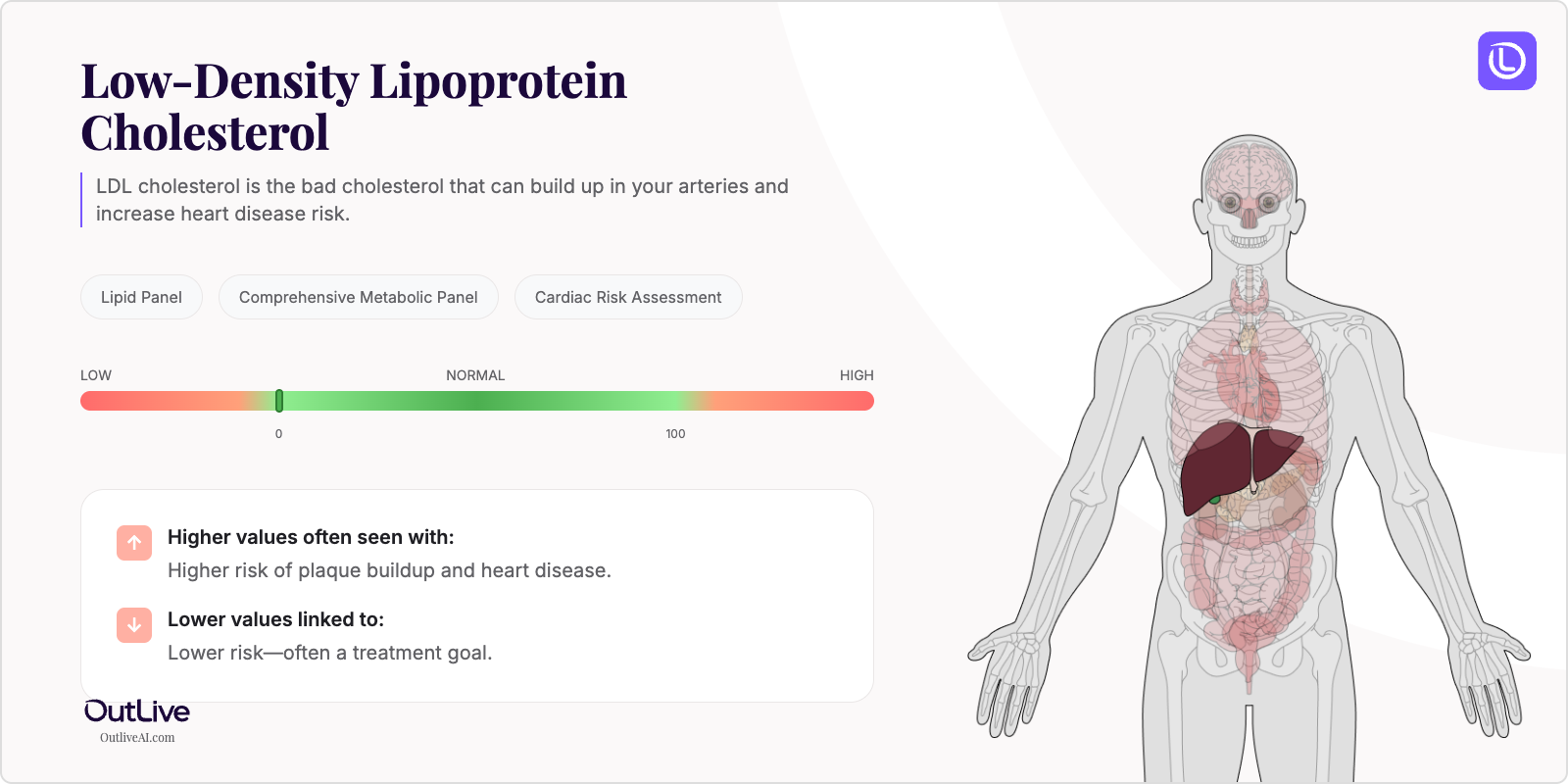 Understanding Your LDL Cholesterol Test Results