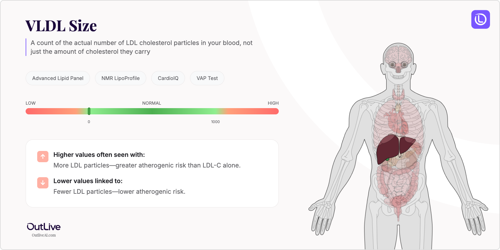 Understanding Your LDL Particle Number Test Results