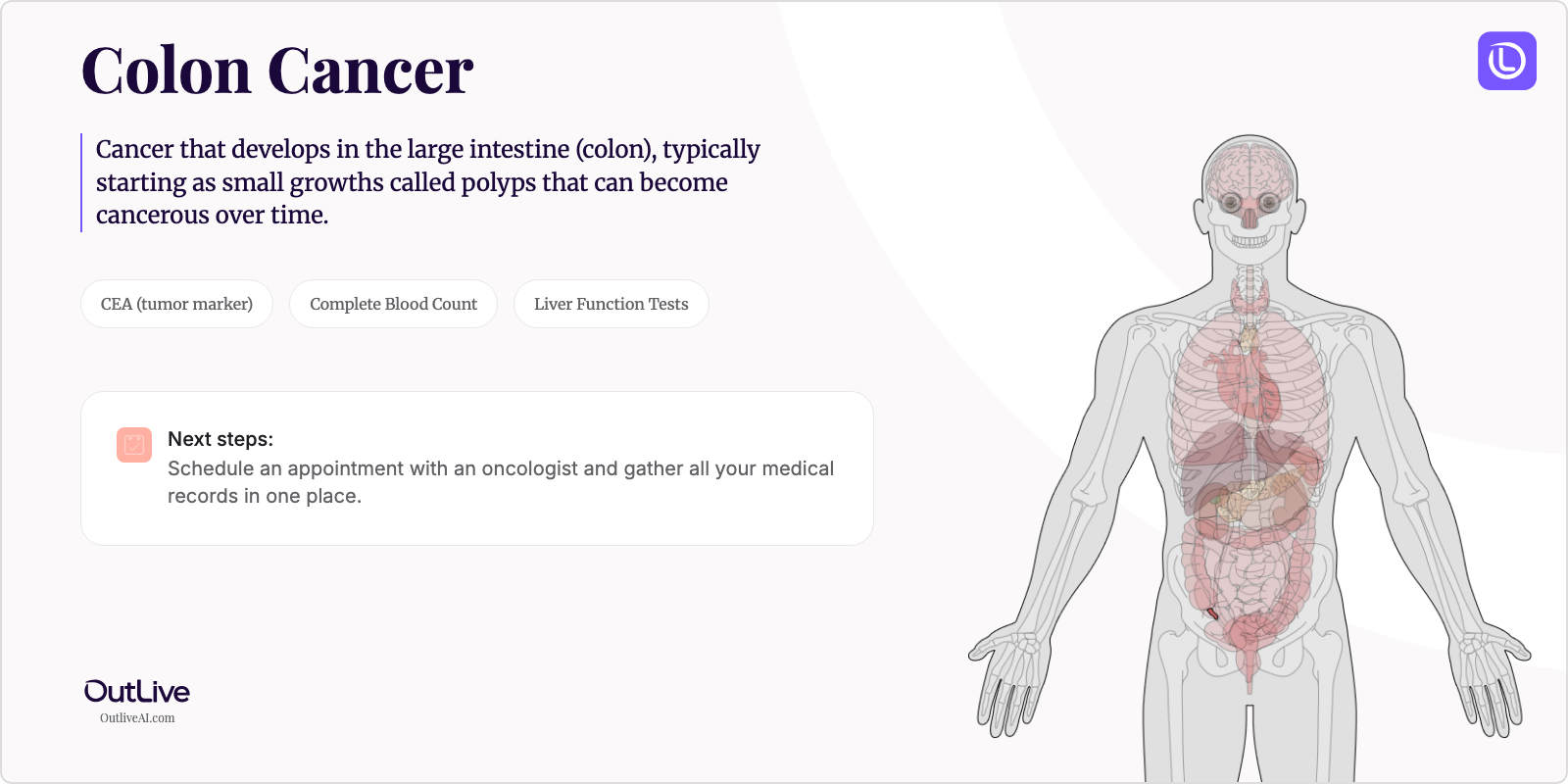 Just Diagnosed with Colon Cancer: A Simple Guide