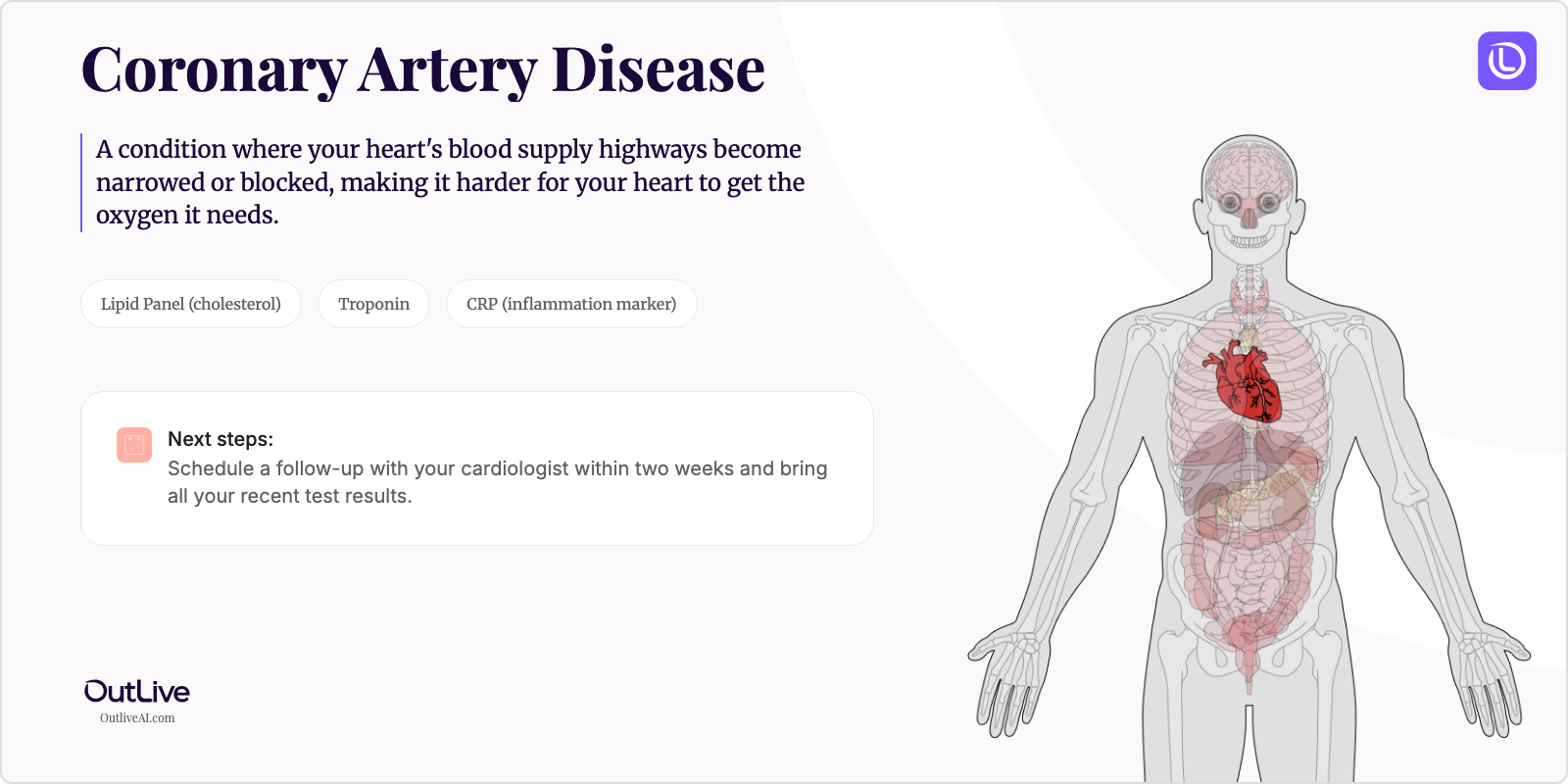 Just Diagnosed with Coronary Artery Disease: A Simple Guide