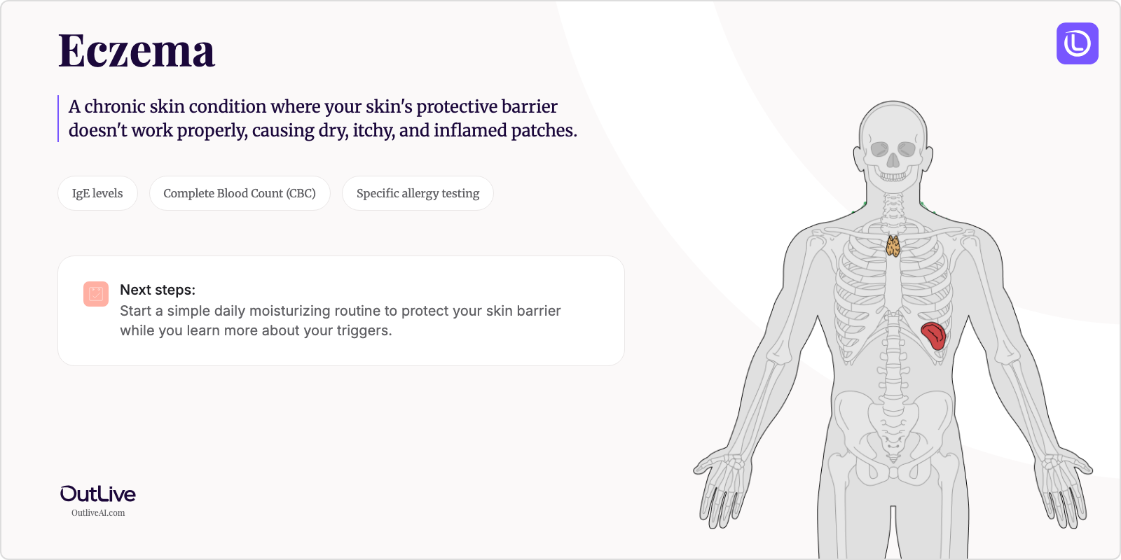 Just Diagnosed with Eczema: A Simple Guide