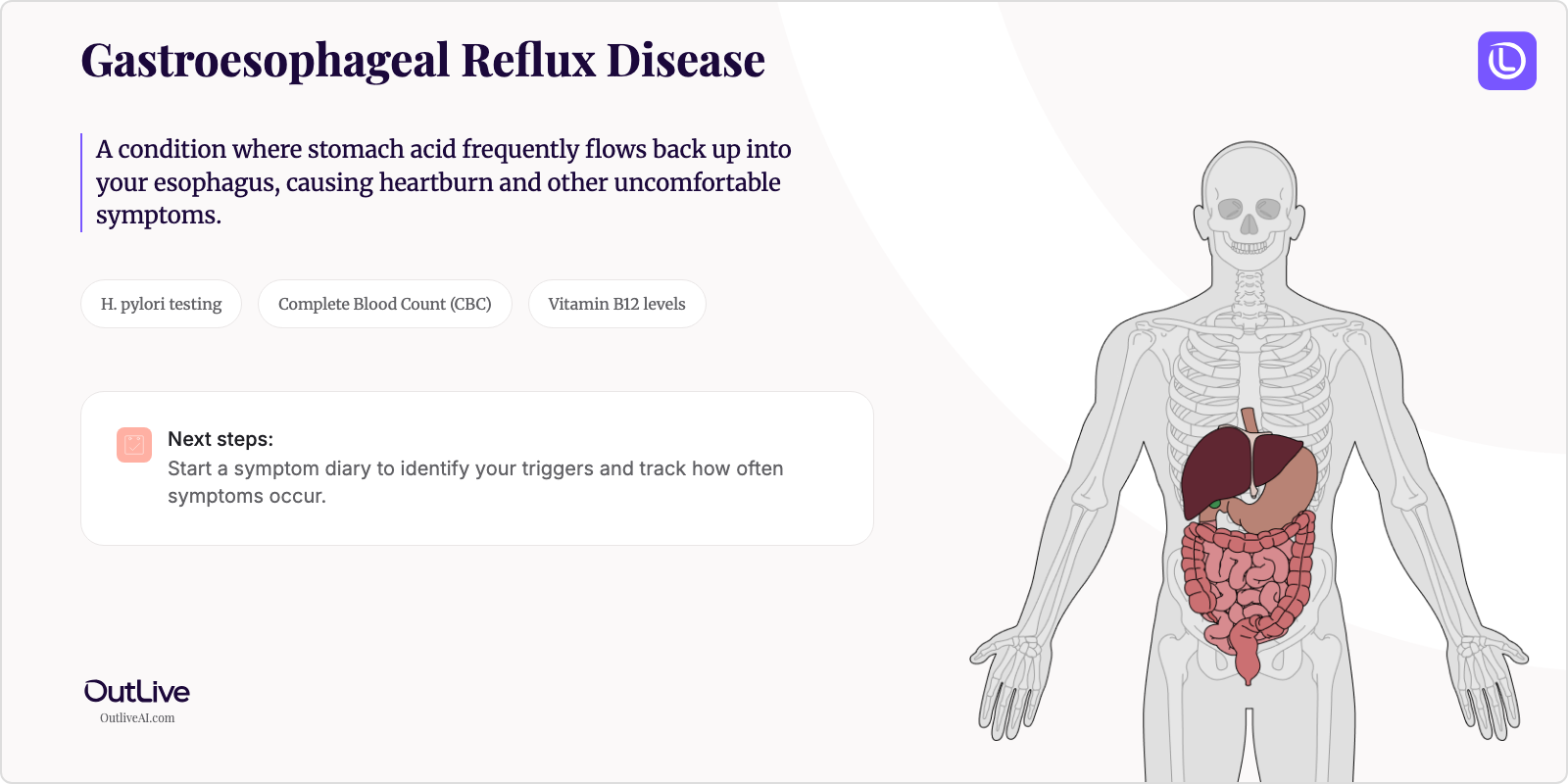 Just Diagnosed with Gastroesophageal Reflux Disease: A Simple Guide