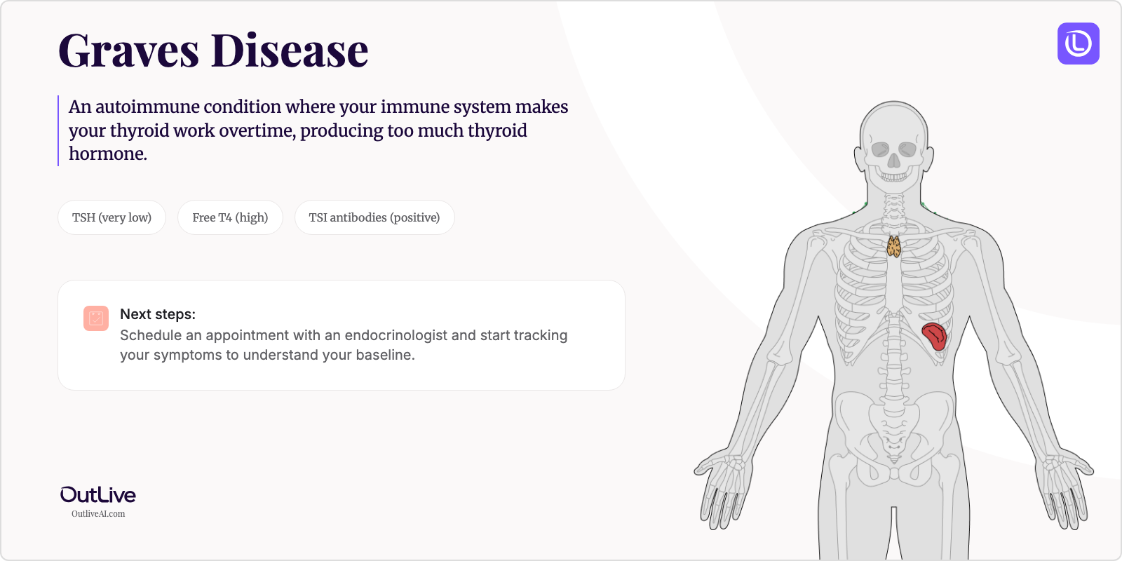 Just Diagnosed with Graves' Disease: A Simple Guide