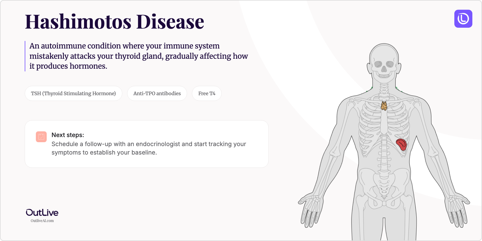 Just Diagnosed with Hashimoto's Disease: A Simple Guide