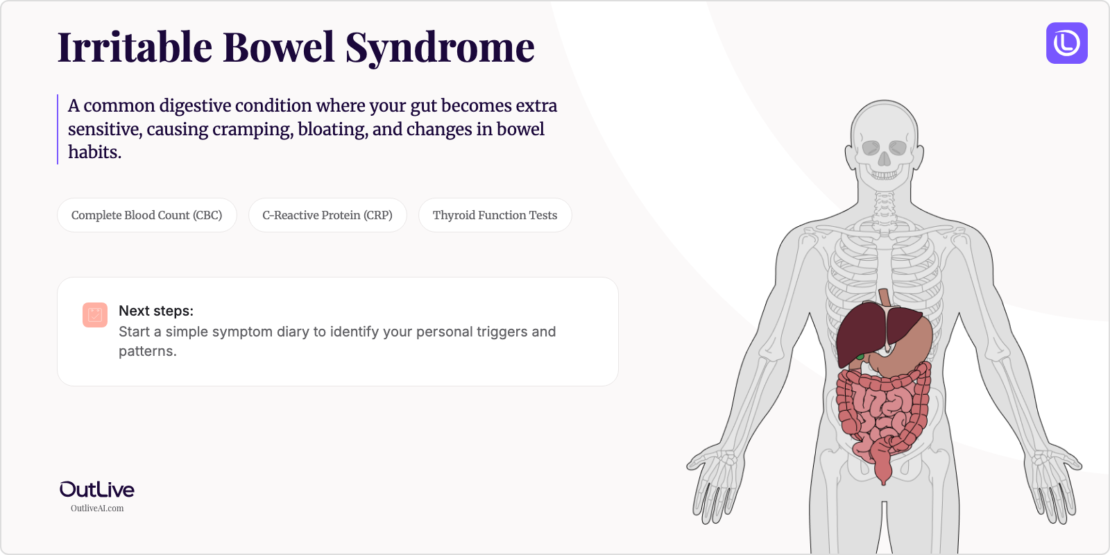 Just Diagnosed with Irritable Bowel Syndrome: A Simple Guide