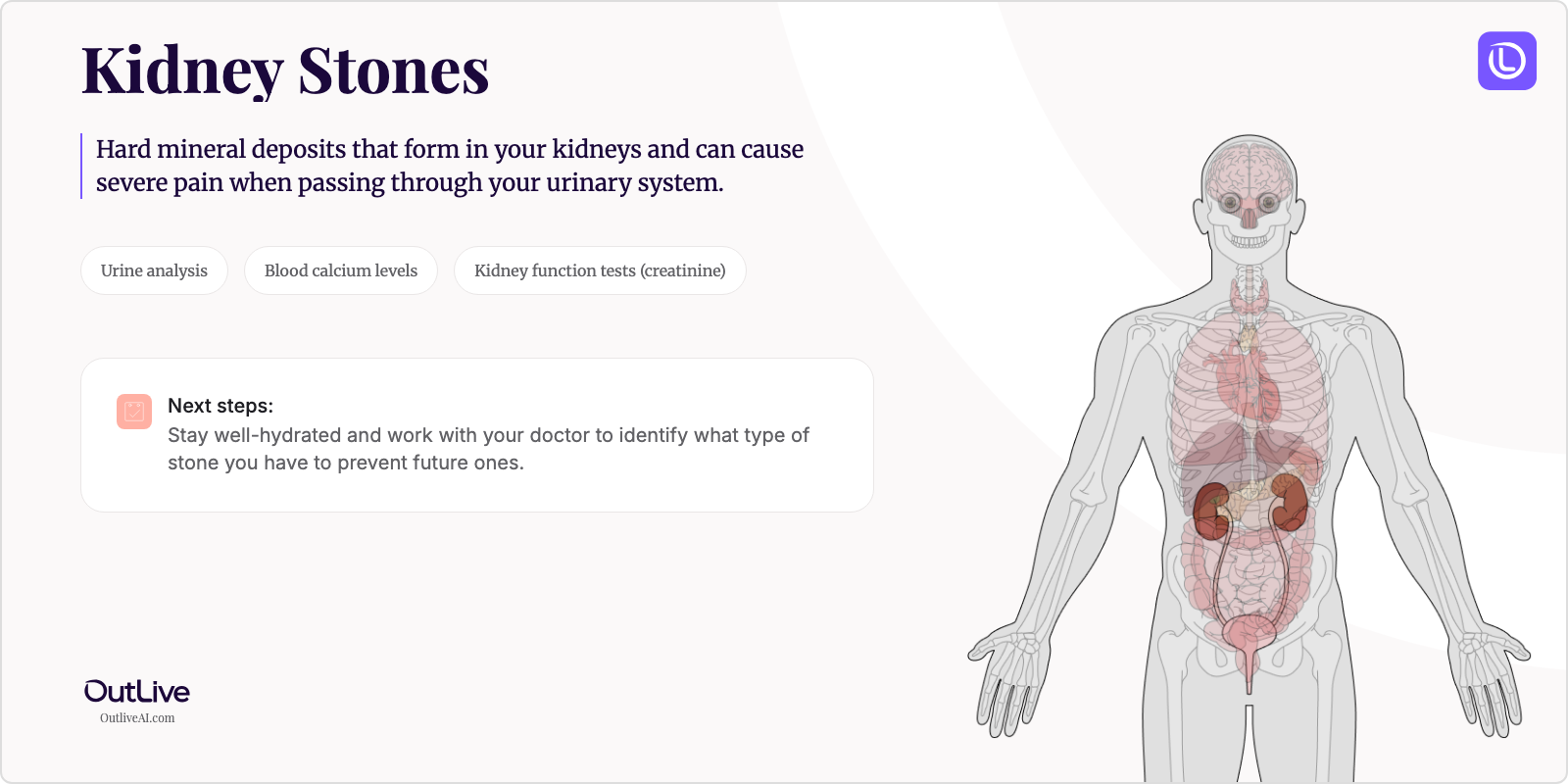 Just Diagnosed with Kidney Stones: A Simple Guide