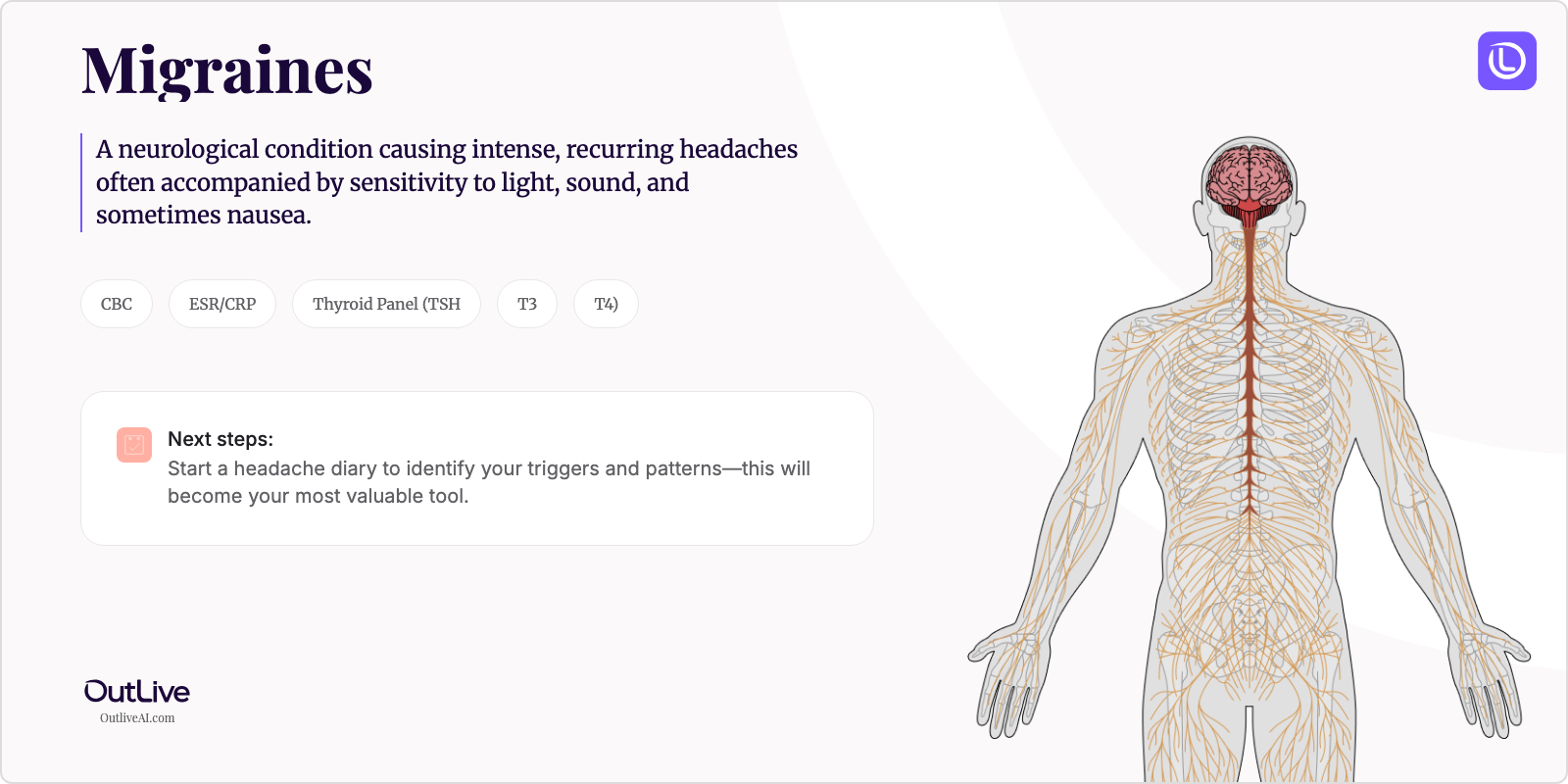 Just Diagnosed with Migraines: A Simple Guide