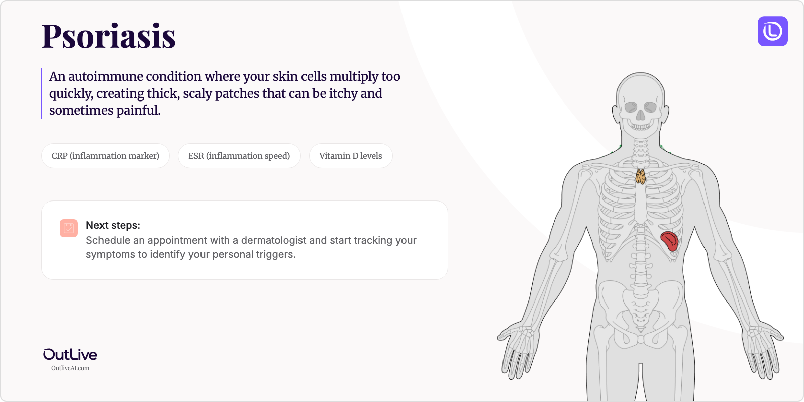 Just Diagnosed with Psoriasis: A Simple Guide