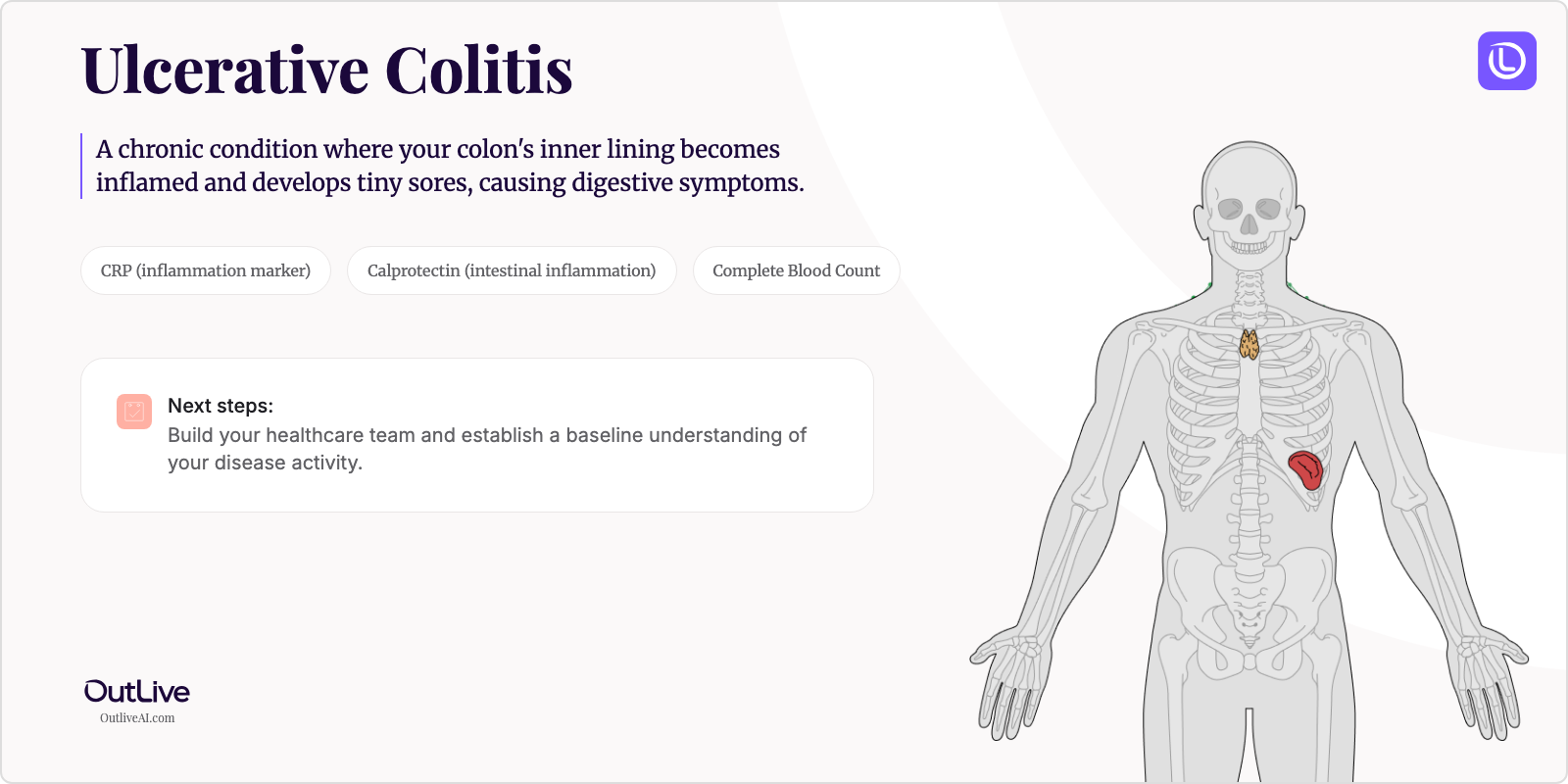 Just Diagnosed with Ulcerative Colitis: A Simple Guide