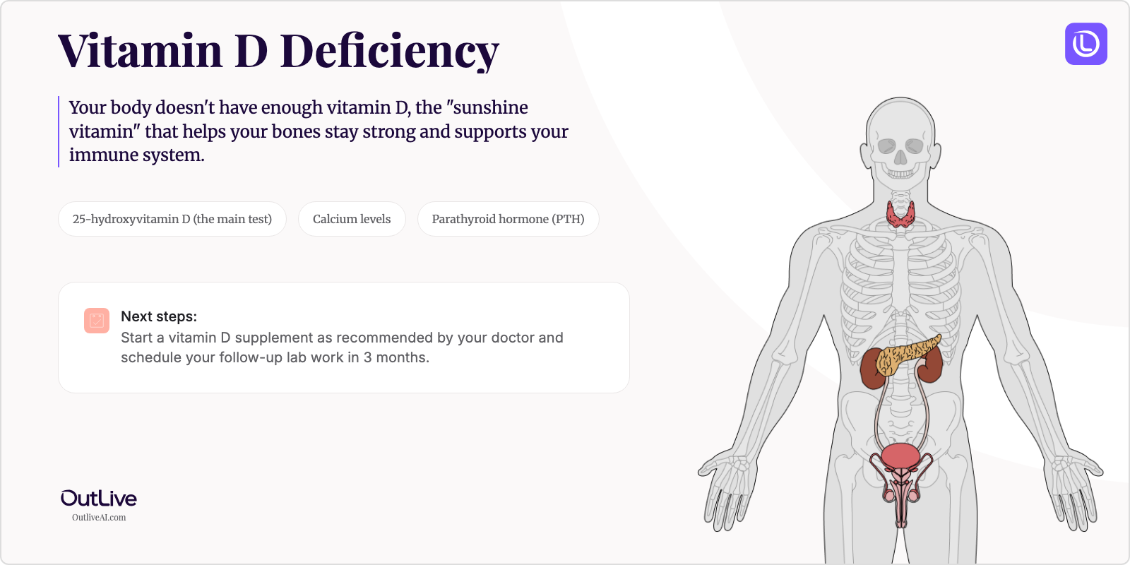 Just Diagnosed with Vitamin D Deficiency: A Simple Guide